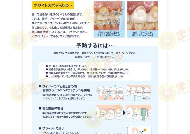 矯正歯科様の矯正中の歯磨き資料制作