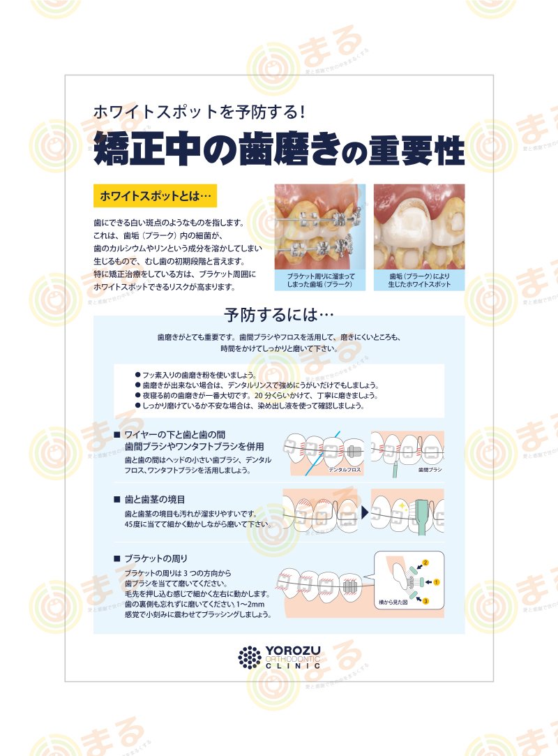 矯正歯科様の矯正中の歯磨き資料制作